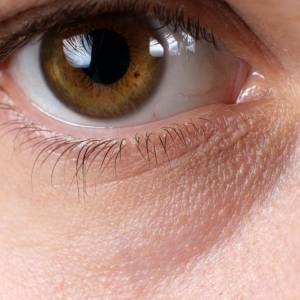 【クマを改善する食べ方】冬に悪化する「目の下のクマ」をケアする食材５選