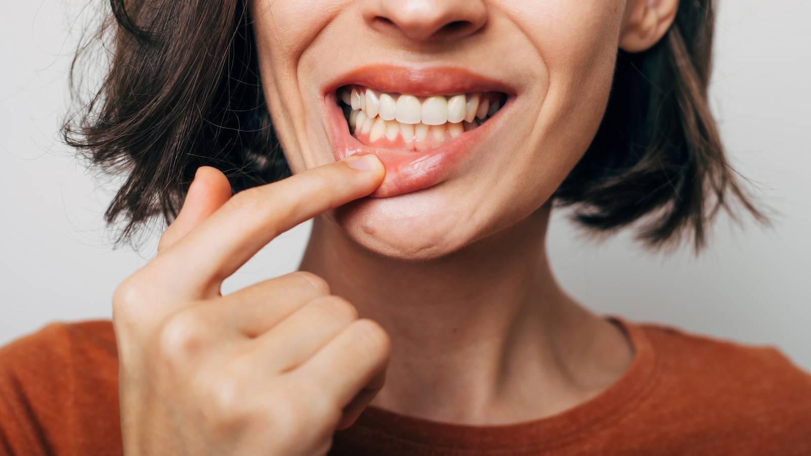  【口の中の細菌が認知症の一因に!?】新たな研究がその可能性を示唆！ 