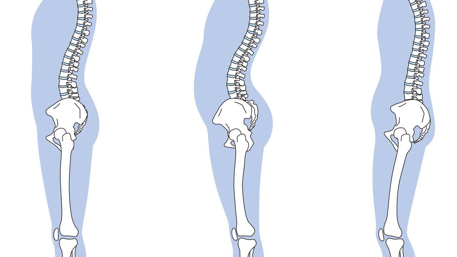反り腰の原因は脚にある？！【反り腰チェック付】改善エクササイズ