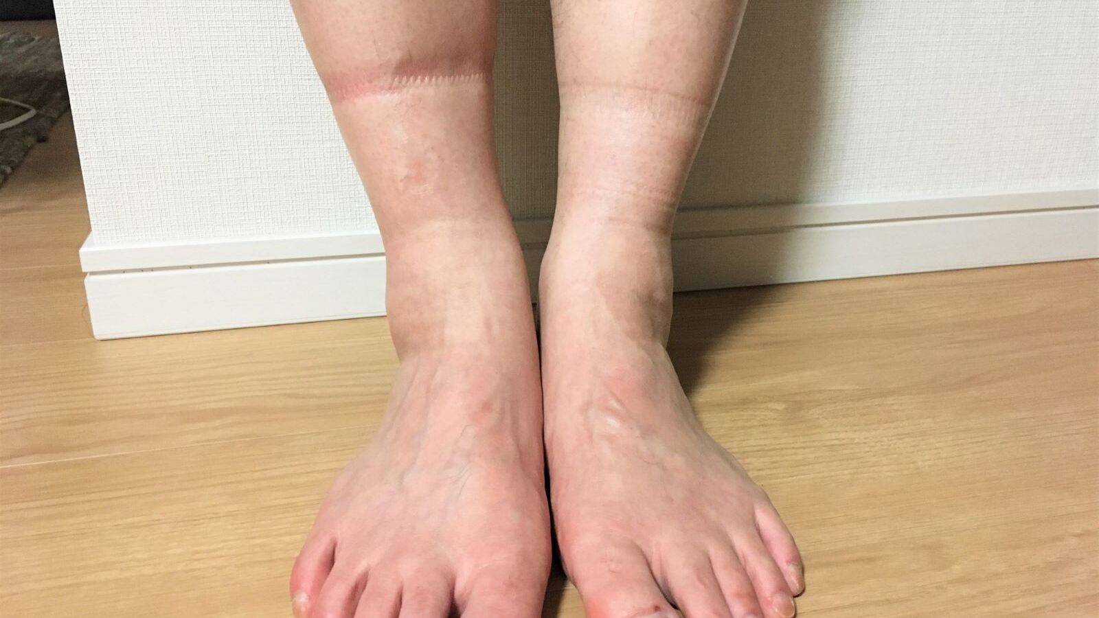 【夕方になると…靴下の跡が気になる人におすすめ】脚のむくみスッキリストレッチ２選