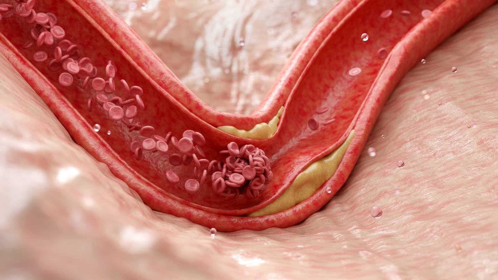 脂質異常症（高コレステロール）とお金：食事療法と薬、どちらがコスパ良い？〈医師監修〉
