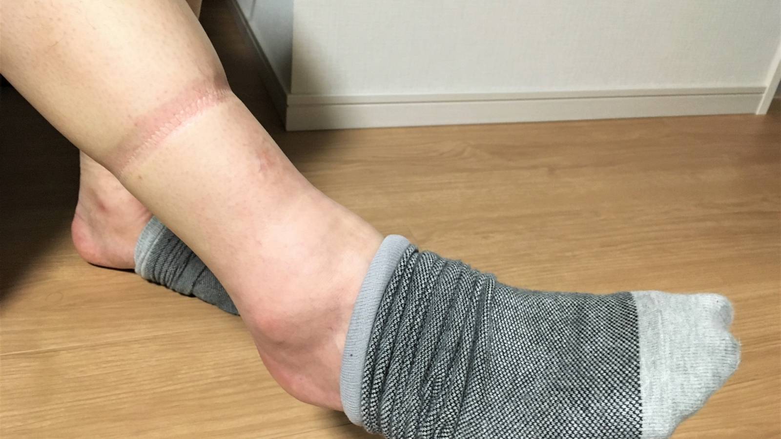 靴下の痕がくっきりつく【むくみ脚】にお困りなら|痛気持ちいい感覚がやみつきになるふくらはぎケア