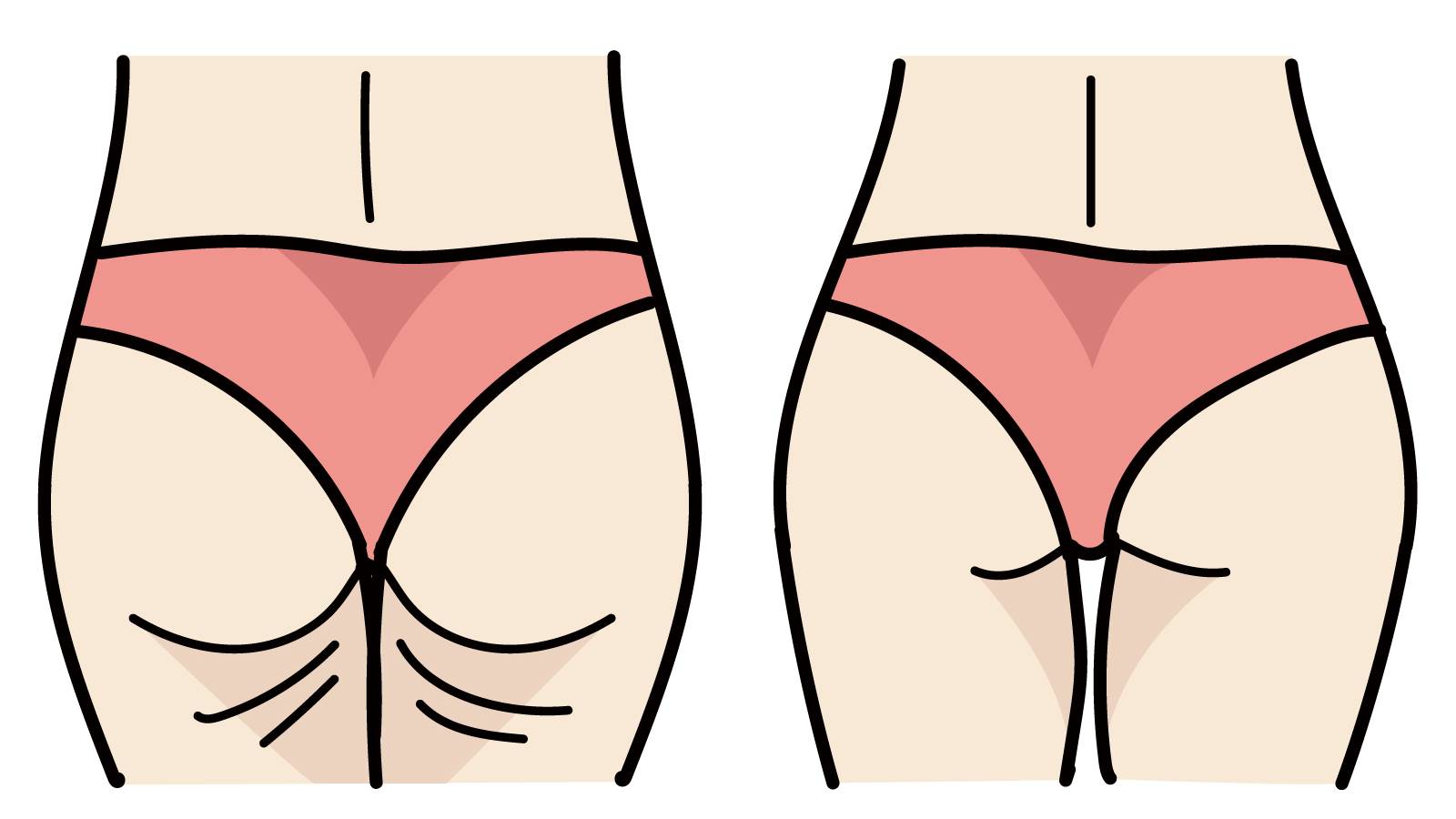 【お尻の下のボコボコセルライトを撃退】1日たった3分でみるみるスッキリ！効き目抜群な美尻ポーズ