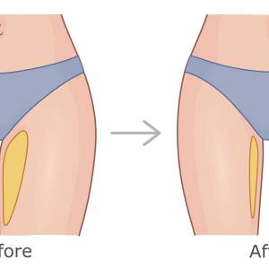 【太もものむっちり感を解消】内ももの鍛え方、正解はこれ！すっきり美脚を目指したい人におすすめ運動