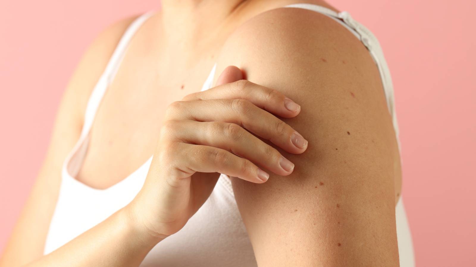 ほくろの形が変わった…もしかして皮膚がん？無視してはいけないサインとは｜医師が解説