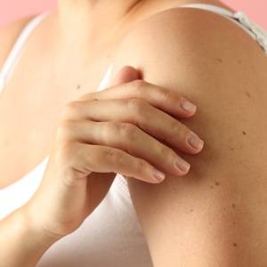 ほくろの形が変わった…もしかして皮膚がん?無視してはいけないサインとは|医師が解説