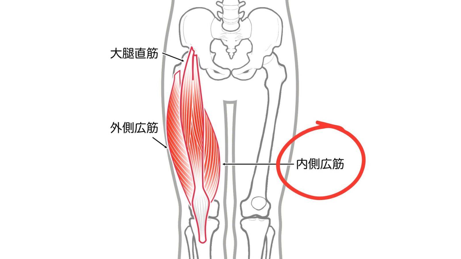 内側広筋