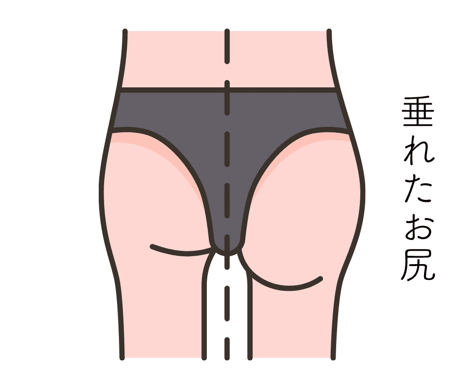 お尻
