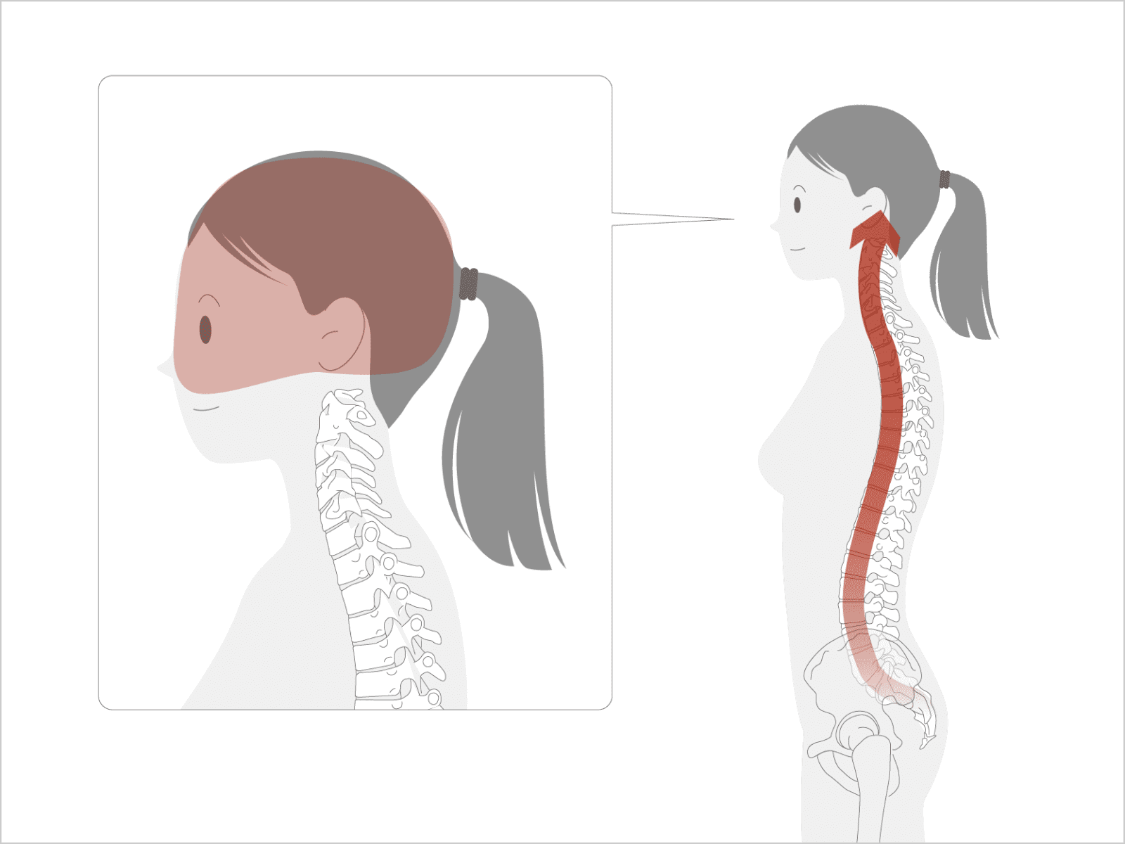 頭は脊椎の先にあって、脊椎は頭のある方へ向かっていく