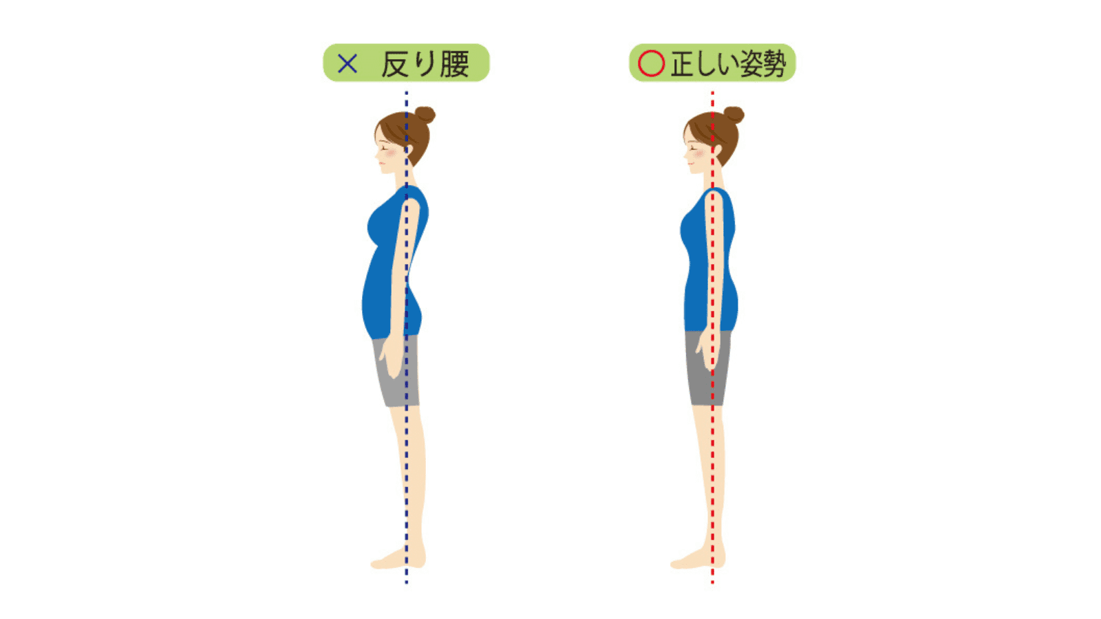 反り腰