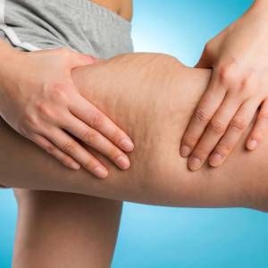 【むっちり太もも、膝上のたるみ肉……】がほっそりシルエットに！２つの大腿四頭筋ストレッチ