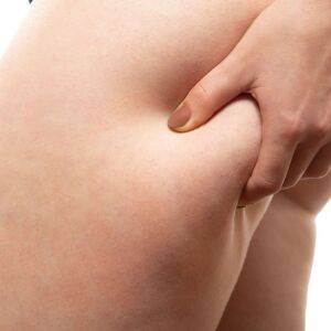 【30分の筋トレに匹敵】見て見ぬフリができなくなった腿裏の贅肉退治に効く「タオルピラティス」