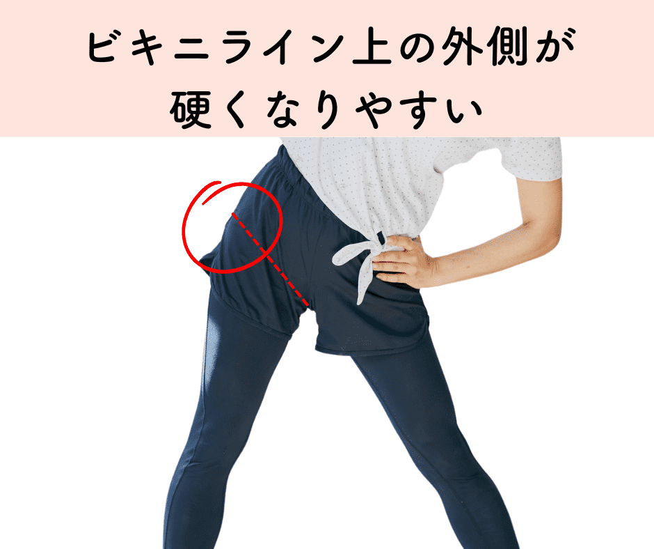 股関節のつまり感