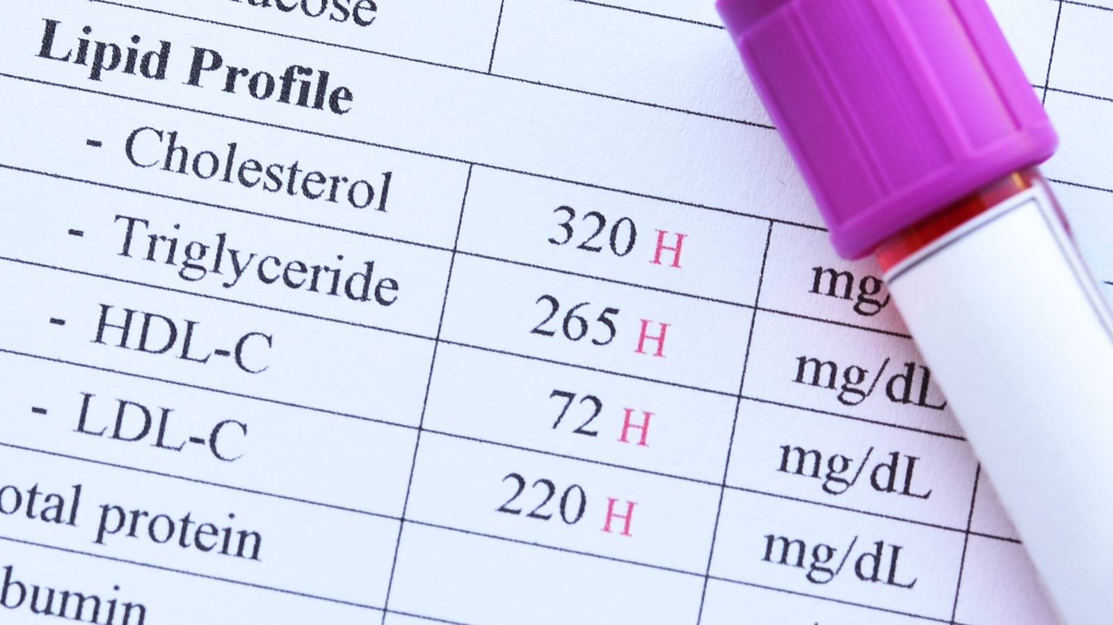 善玉コレステロールって？脂質異常症の予防に必要なコレステロールと食事の関係性は｜管理栄養士解説