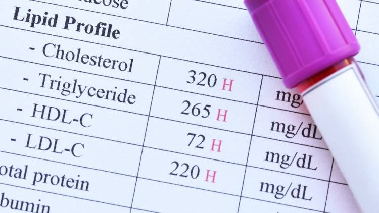 善玉コレステロールって？脂質異常症の予防に必要なコレステロールと食事の関係性は｜管理栄養士解説