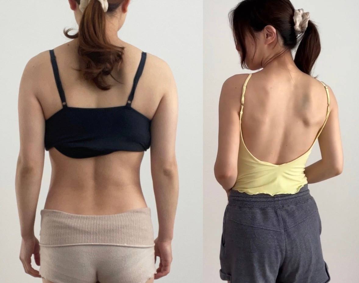 背中のビフォーアフター