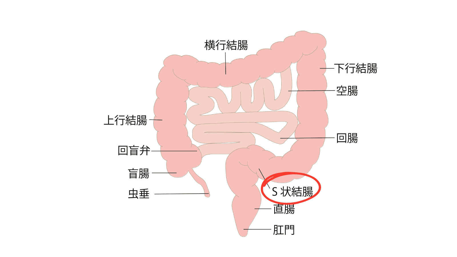 S状結腸