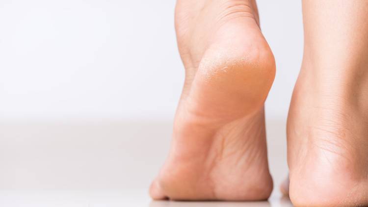 乾燥肌だと思っていたら、実は糖尿病のサインかも？注意したい肌の変化とは｜医師が解説