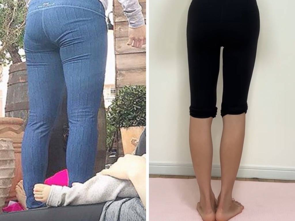 ビフォーアフター