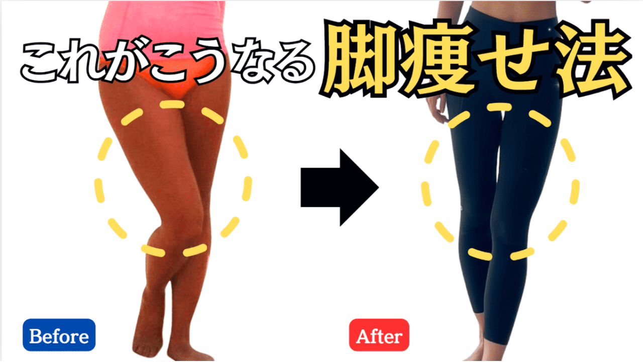 脚の太さ・X脚・O脚にお悩みの人へ…「外ももの張り」を取ってスッキリさせる集中ストレッチ