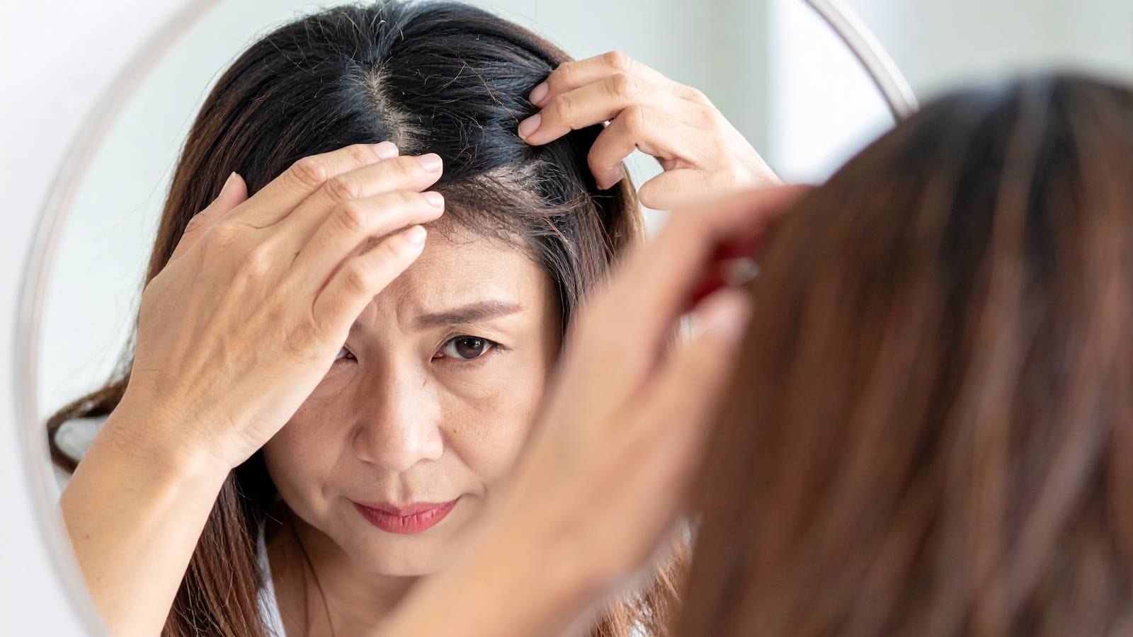 不足すると脱毛につながる？皮膚などの健康を支える〈ビオチン〉の気になる働きとは｜管理栄養士が解説