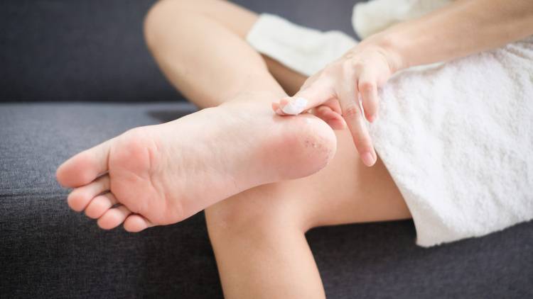 【皮膚科医が警鐘】かかと荒れは足裏の「温度差」が原因？！猛暑日には約40℃差を行き来も