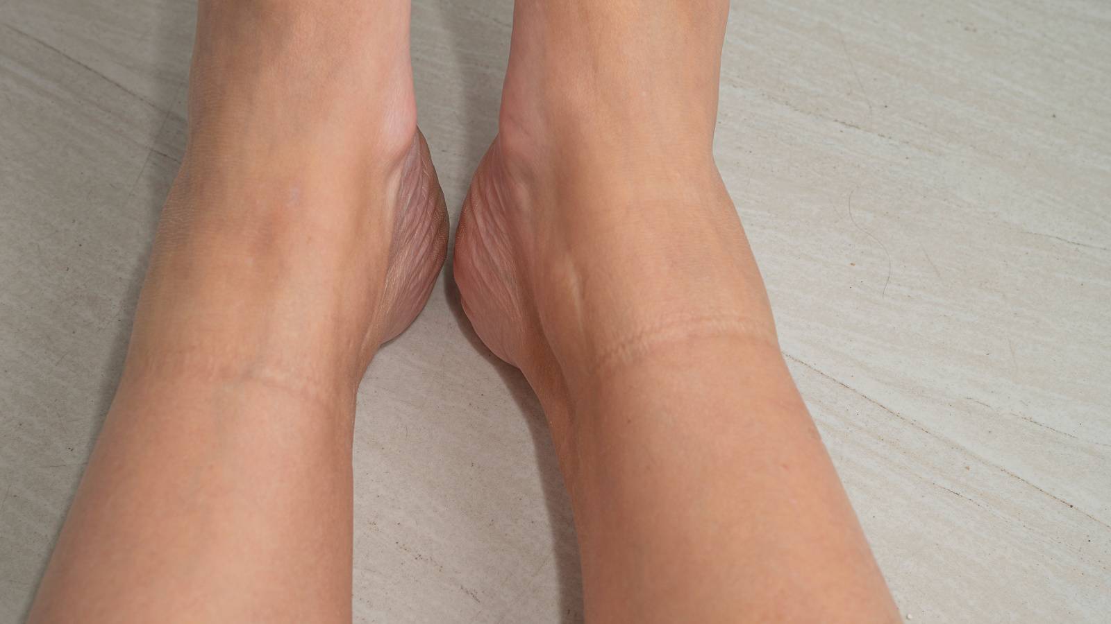 医師が教える〈腎臓が弱っているサイン〉とは？腎臓は我慢強い臓器。だからこそ知っておきたいこと