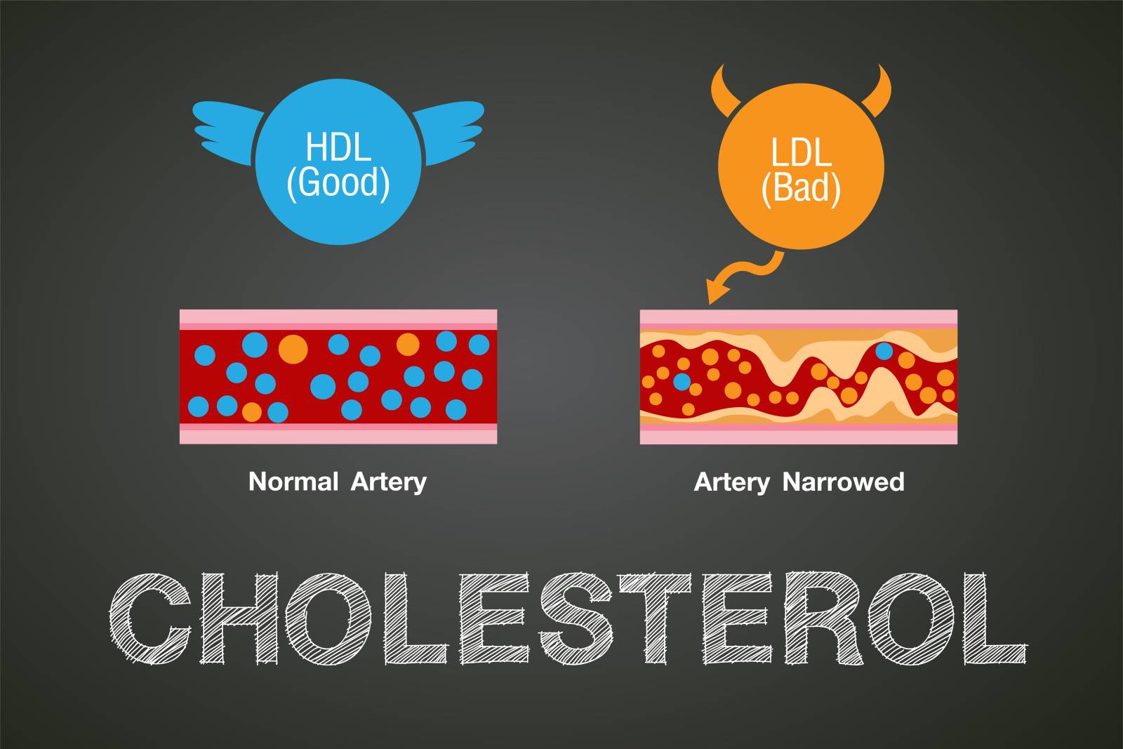 コレステロール