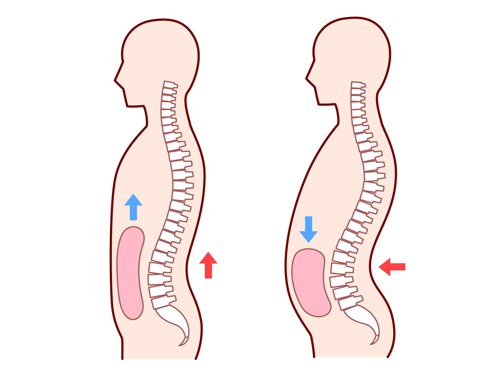 内臓下垂のイメージ