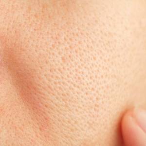 毛穴が目立つのは肌内部の「隠れ老化」のサインかも？美容皮膚科医が教える40代からの毛穴対策