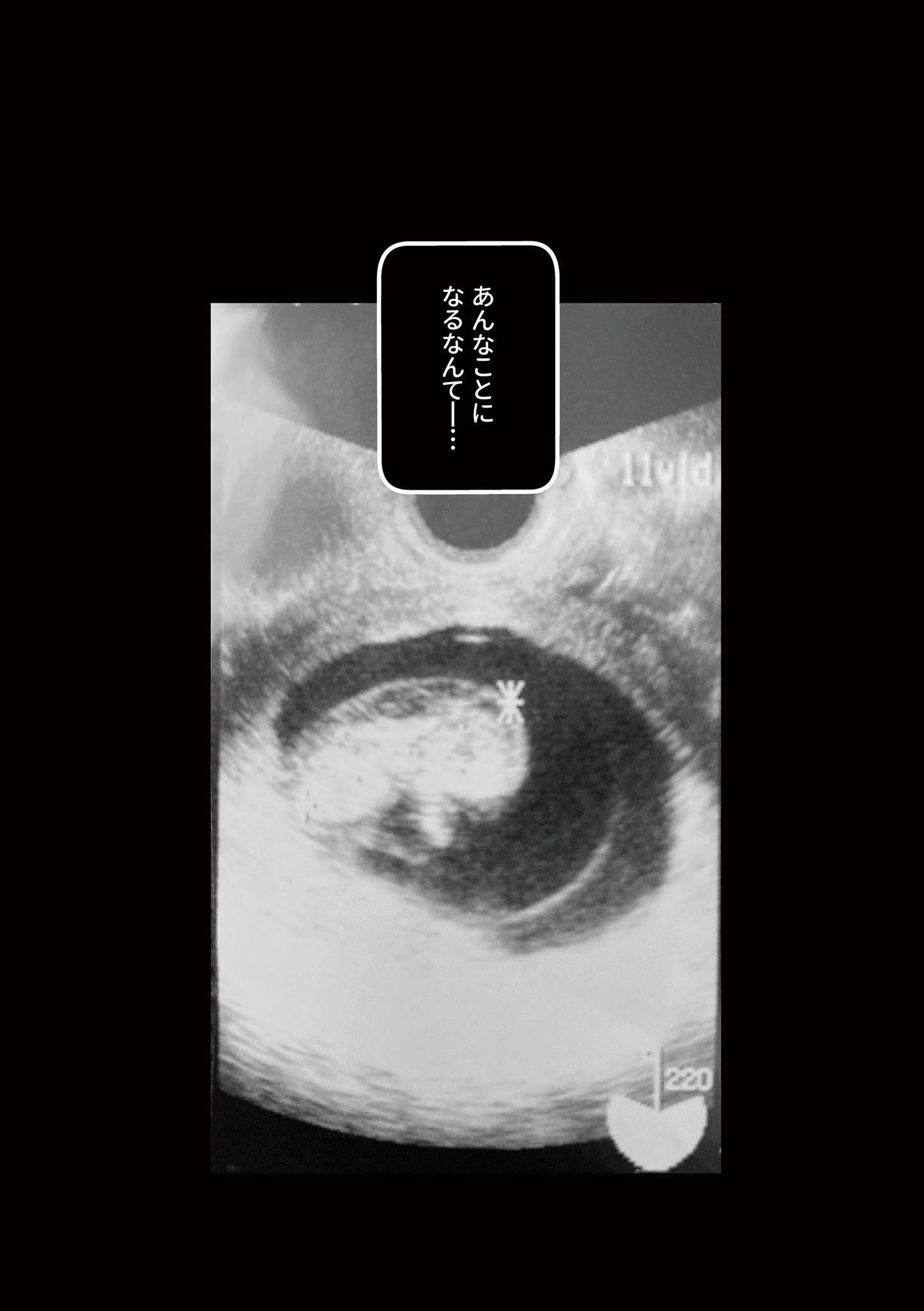 『わたしが選んだ死産の話』（KADOKAWA）より