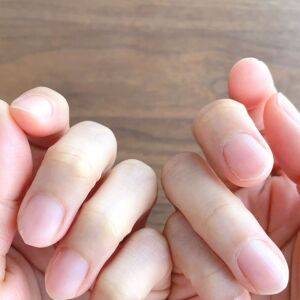 手首や手指の痛み、腱鞘炎の予防や不調の緩和のためのヒント