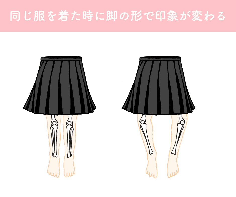 O脚だと脚が太く見える例