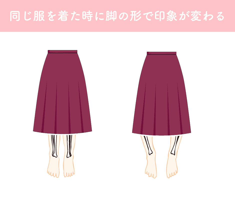 O脚だと脚が太く見える例