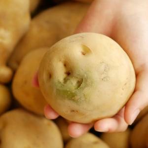 じゃがいもには毒がある?皮ごと食べるときの注意点とは|管理栄養士が解説