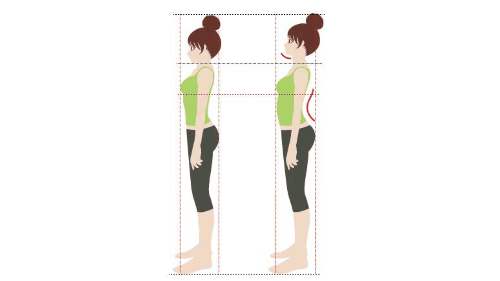 反り腰　イラスト