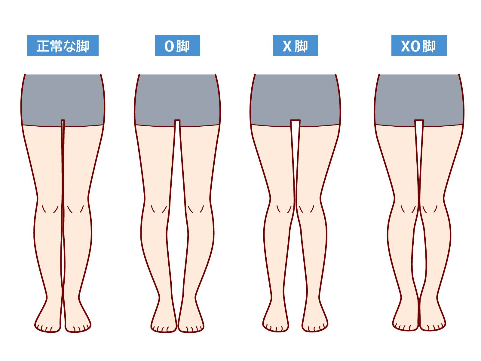 脚の形