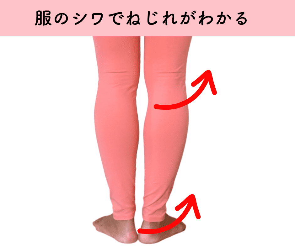 膝下のねじれ