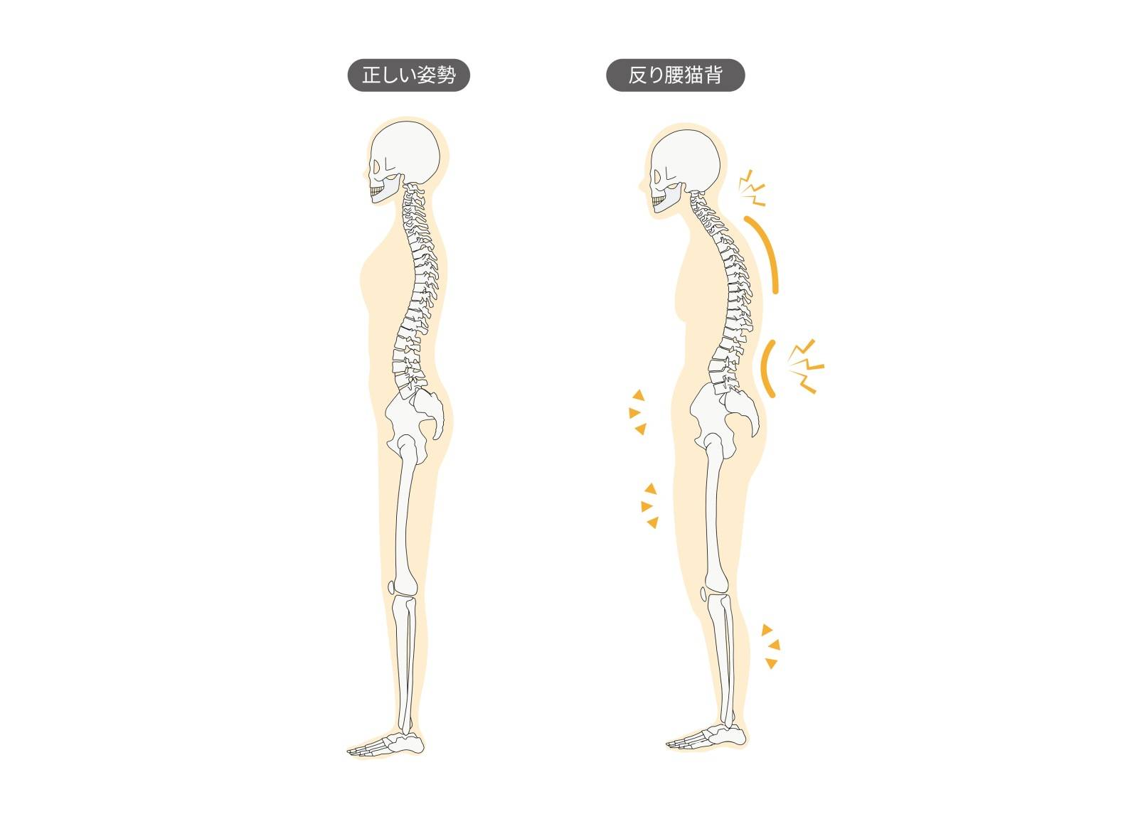 姿勢が悪いとふくらはぎも太くなる