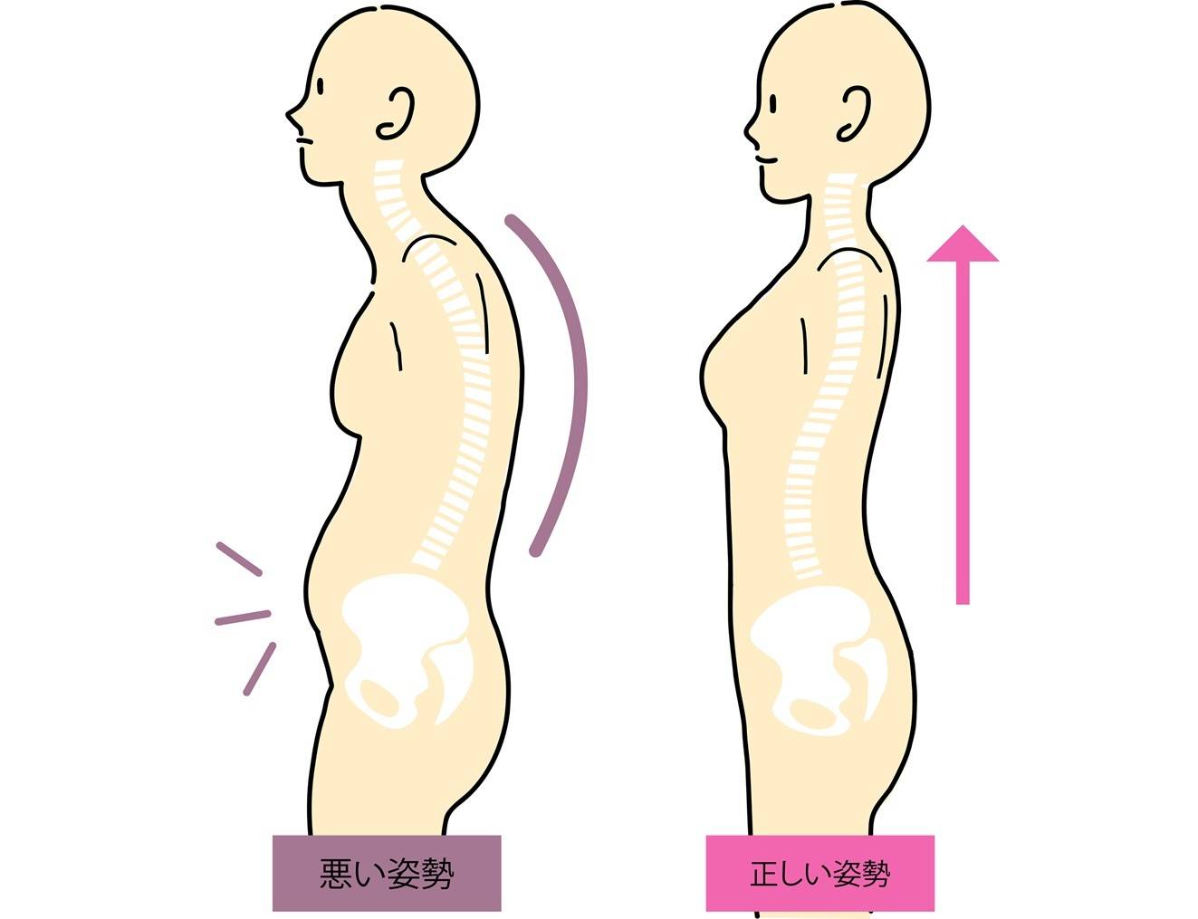 腸腰筋で姿勢が崩れる