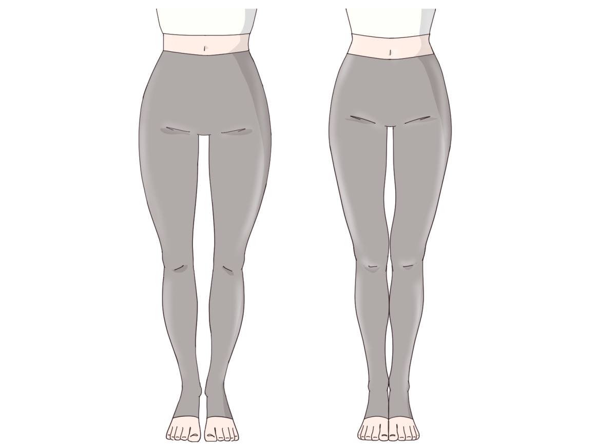 ねじれのイメージ