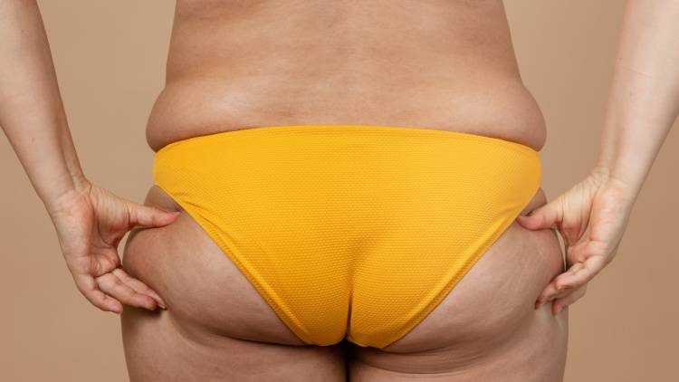 お尻が四角く見えるのは"中殿筋の衰え"が原因。40代のヒップラインが上向く矯正エクサ