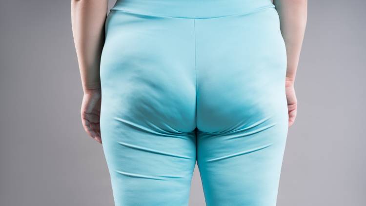 【時短トレで脂肪を燃やし正月太り撃退】お尻まわりの筋力低下とむくみを同時に解消。垂れ尻がキュッと引き締まる！