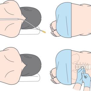 無痛分娩は本当に安全？「硬膜外鎮痛法」の仕組み・安全性・費用を産婦人科医が徹底解説