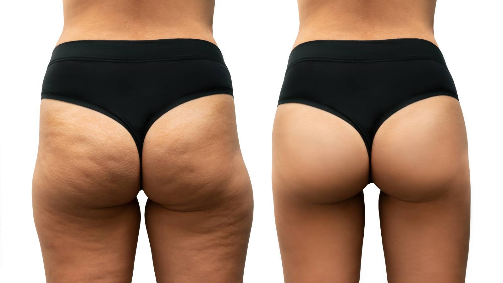 スクワットもランジも効かない垂れ尻にはコレ！四角いお尻を丸く引き上げる「地味トレ」