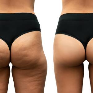 スクワットもランジも効かない垂れ尻にはコレ！四角いお尻を丸く引き上げる「地味トレ」