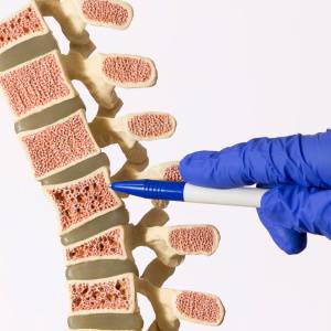 骨粗しょう症予防に！ 【管理栄養士おすすめ】レシピ2種を紹介