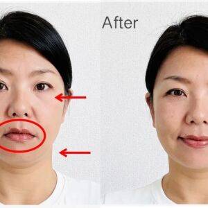 効果実証済！クマ消し・フェイスライン引き締め…顔の老け見え対策に【若返りフェイスマッサージ】