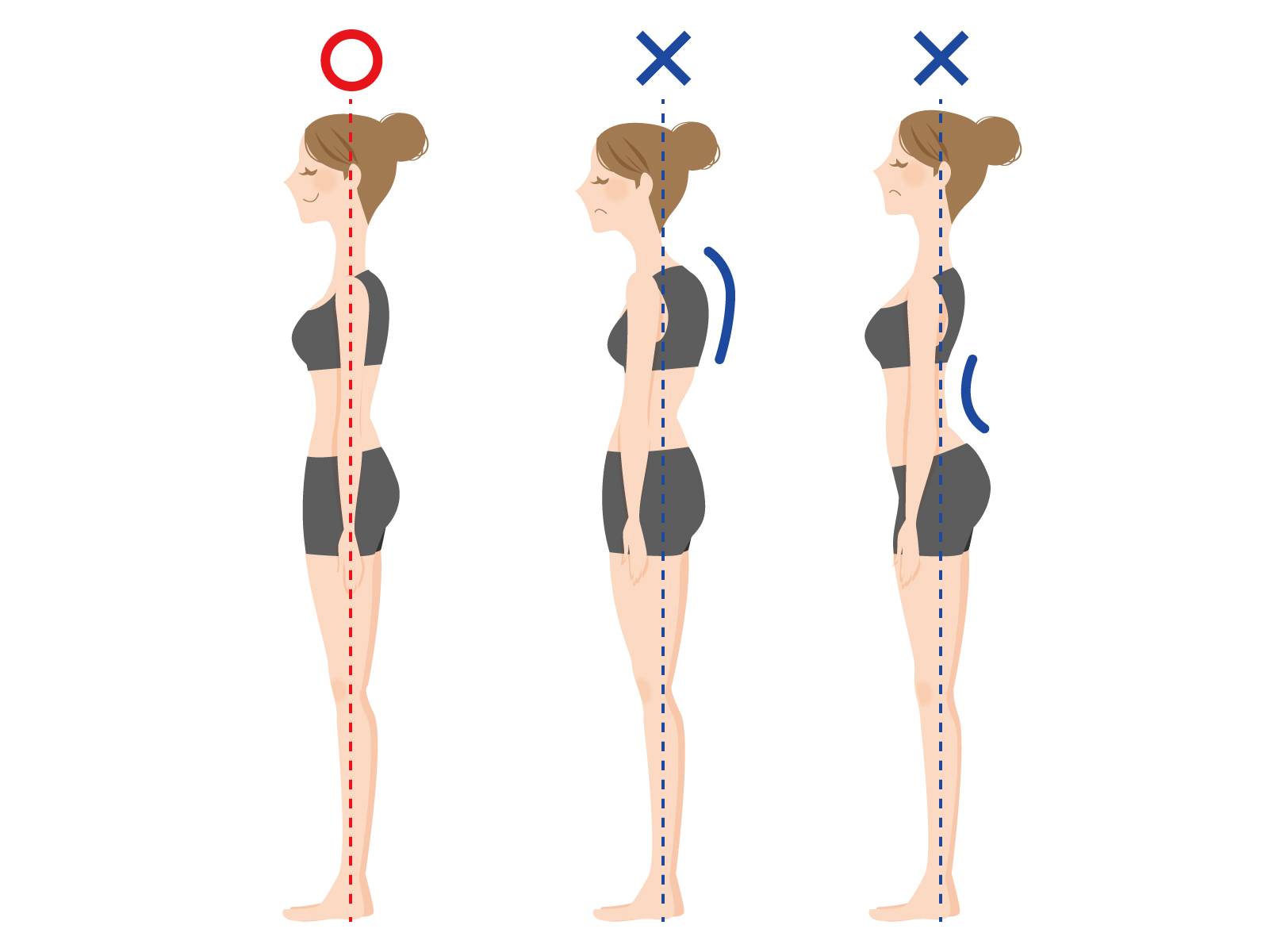 正しい姿勢、猫背、反り腰