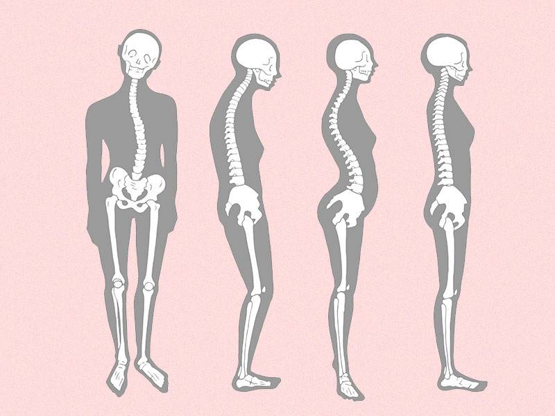 ヒップウォークで骨盤リセット